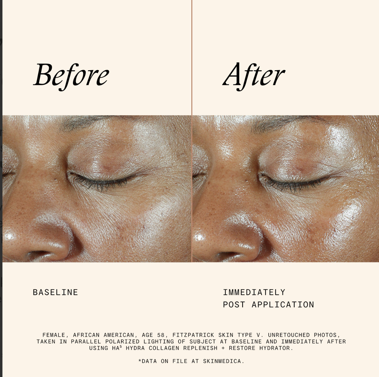 Skin Medica Products HA5
