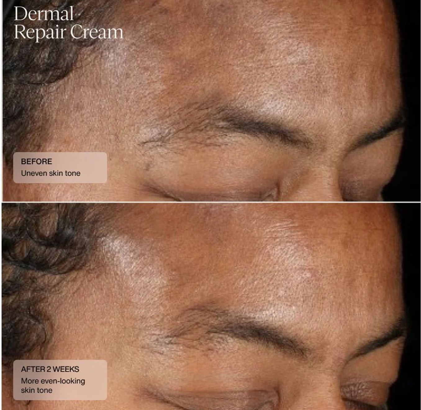 SENTE Dermal Repair